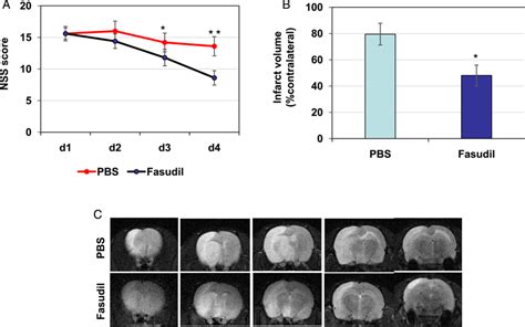 Effects Of Fasudil On Neurological Functions And Infarct Volume In Mcao