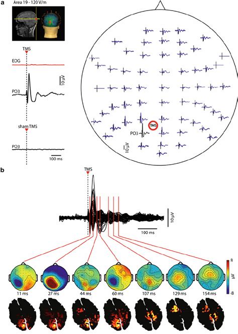 EEG Responses And Cortical Activations Evoked By TMS Of Area 19 The