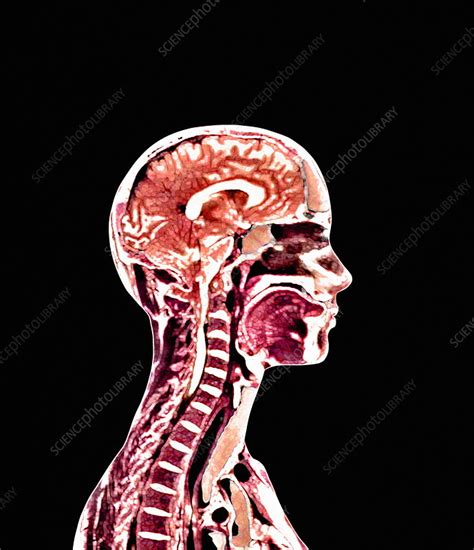 Brain and spinal cord - Stock Image - F001/2105 - Science Photo Library