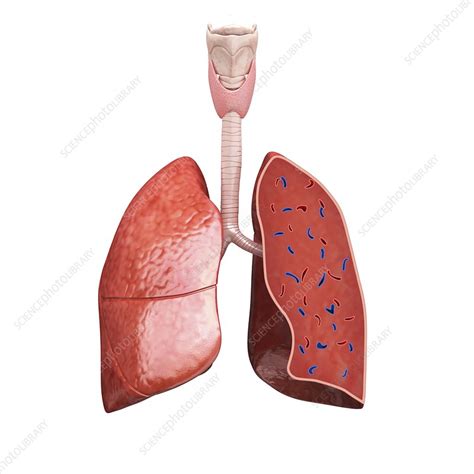 Cross Section Of Lungs Illustration Stock Image F012 1770