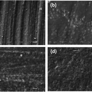 Representative Scanning Electron Microscopy Micrographs Of Dentin