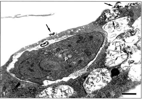 Transmission Electron Micrograph Of Human Umbilical Endothelial Cells