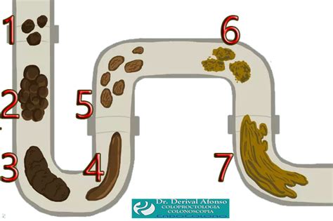 O Que O Formato Das Fezes Indica Haru Sa De Integrada Verloop Io
