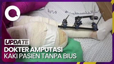 Cerita Dokter Gaza Amputasi Kaki Keponakan Di Rumah Tanpa Bius