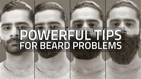 8 Powerful Tips For All Your Beard Problems Youtube