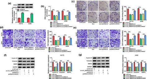 Exosomal Hsa Circ 0000519 Modulates The NSCLC Cell Growth And