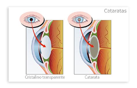 Cl Nica Oftalmol Gica M Laga Oftalm Logo M Laga