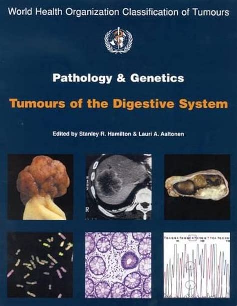 Amazon World Health Organization Classification Of Tumours Pathology