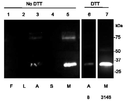 Western Blot Analysis Of Whole Tissue Extracts Of Dracunculus