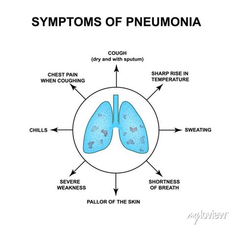 Symptoms of pneumonia. world pneumonia day. the anatomical structure ...