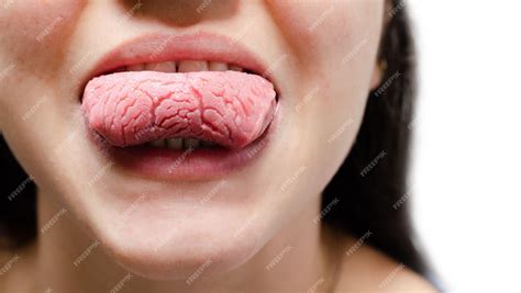 Premium Photo | Tongue of a young Caucasian woman with benign migratory ...