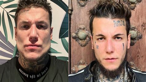 Alex Caniggia se hizo una operación en la mandíbula Entretenimientos