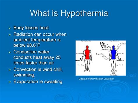 Ppt Hypothermia Powerpoint Presentation Id294122