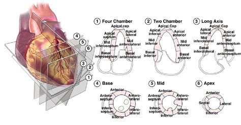 Automatic Classification Of Left Ventricular Regional Wall Motion