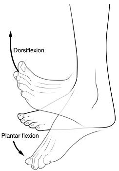 Dorsiflexion Definition Contracture Study