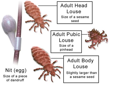 Getting Rid Of Lice In Your Pubic Area Crabs Lice Zapper