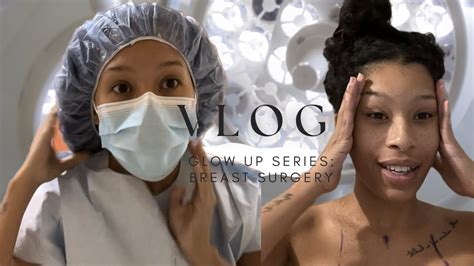 Glow Up Series Breast Augmentation Surgery Vlog Youtube