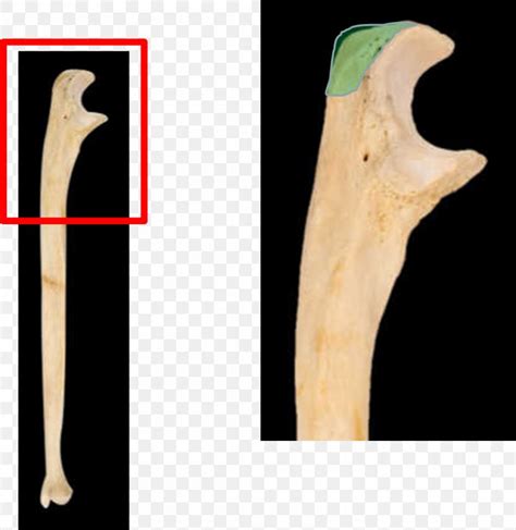 Olecranon Coronoid Process Of The Ulna Ulnar Styloid Process Trochlear Notch, PNG, 986x1016px ...