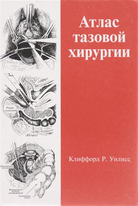 Атлас тазовой хирургии - купить с доставкой по выгодным ценам в ...