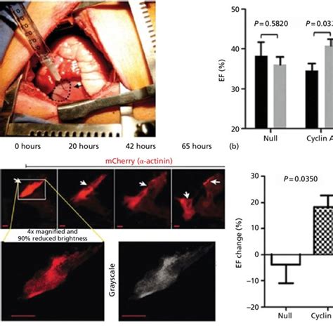 1 Two key approaches towards cardiac regeneration: Inducing the ...