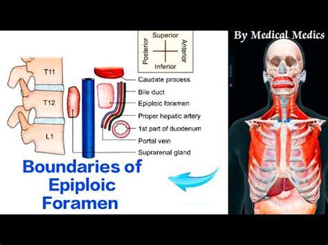 Epiploic Foramen | Boundaries of Foramen of Winslow | Medical Medics ...