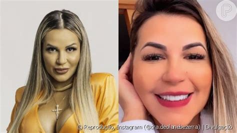 Deolane Bezerra Antes E Depois Doutora Retira Preenchimento Labial E