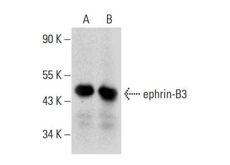 Ephrin B3抗体 A 7 Scbt Santa Cruz Biotechnology