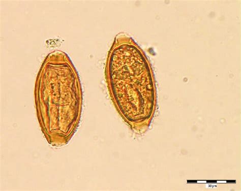 Trichuris Trichiura Scheda Parassitologica Ed Approfondimenti