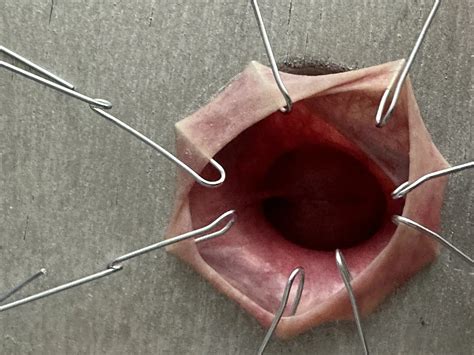 Cbt 6 Nude Pics XHamster