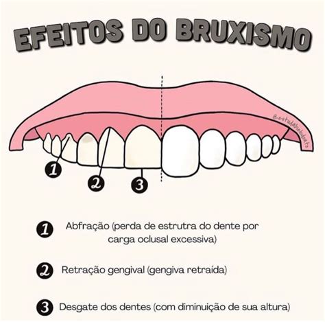 Pin De Raiza Braga Em Salvamentos R Pidos Escola De Higiene Dental