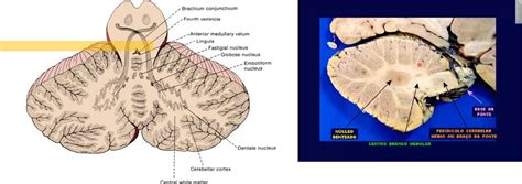 CEREBELO RESUMO Neuroanatomia