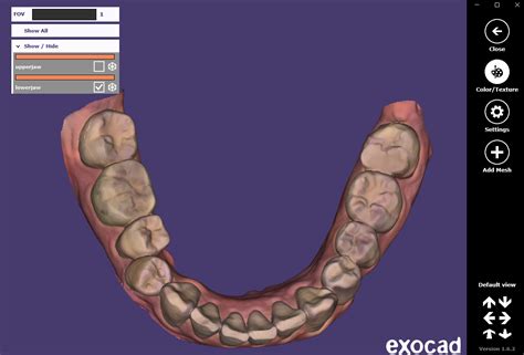 Blog Understanding D Model File Formats In Digital Dentistry Stl Vs