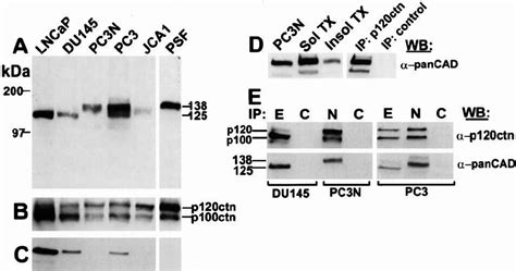 Immunoblot Analysis Of E Cadherin And P120 Ctn Catenin In Prostate Download Scientific Diagram