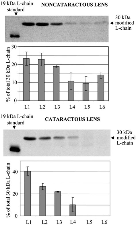 Western Blot Analysis Of The Distribution Of 30 KDa Ferritin L Chains