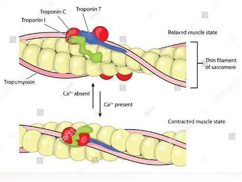 Cardiac Troponins -Troponin I ,Troponin T TEST - Clinical Laboratory Guide