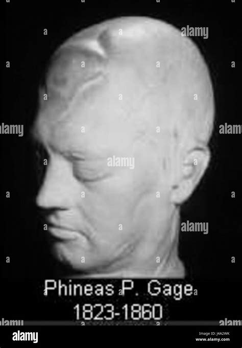 Phineas P Gage Hi Res Stock Photography And Images Alamy