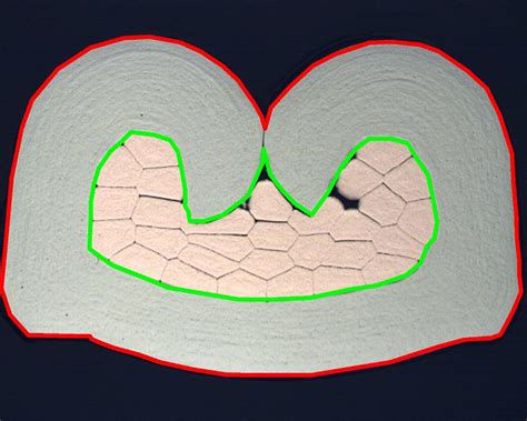 Crimp Cross Section Analysis