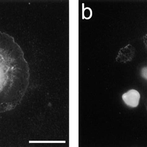 Mt1 Mmp Immunoreactivity In C6 Glioblastoma Cells And Download