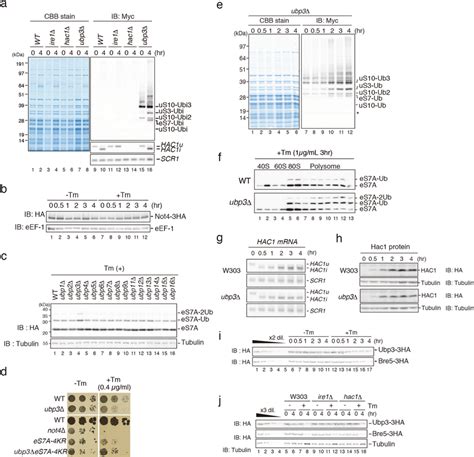 Deubiquitinating Enzyme Complex Upb3 Bre5 Is Involved In The Regulation