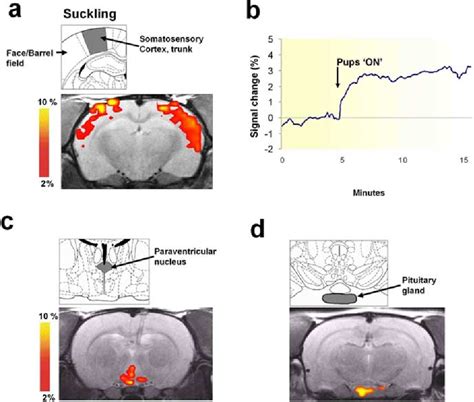 Figure 2 From Functional Magnetic Resonance Imaging Shows Oxytocin