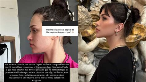 Flavia Pavanelli antes e depois de procedimentos estéticos biografia