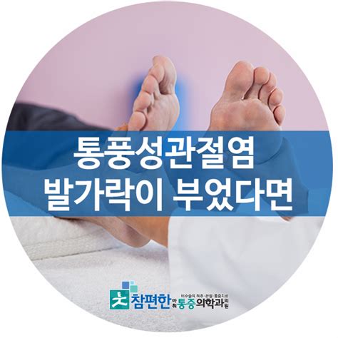 연신내 통증의학과 통풍성관절염 발가락이 부었다면 네이버 블로그