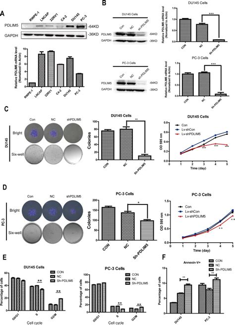 High Expression Of Pdlim Facilitates Cell Tumorigenesis And Migration