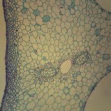 Collenchyma Tissue, c.s., 12 µm Microscope Slide | Carolina.com