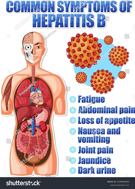 Informative Poster Common Symptoms Hepatitis B Stock Vector (Royalty ...