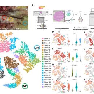 Clustering And Spatial Distribution Of The Spots From Pancreatic Tumor