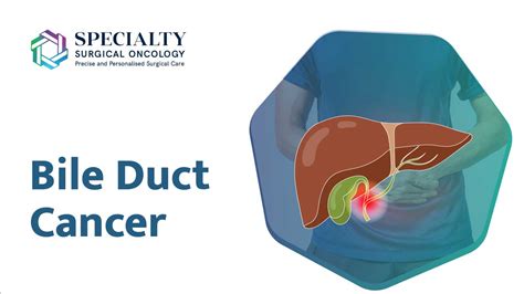 Bile Duct Cancer Treatment in Mumbai | SSOHospital