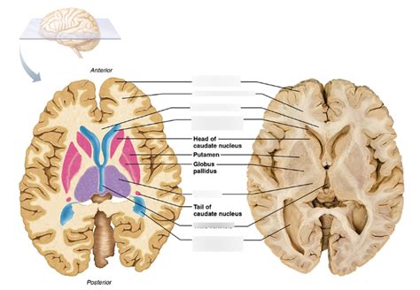 Transverse Brain Diagram