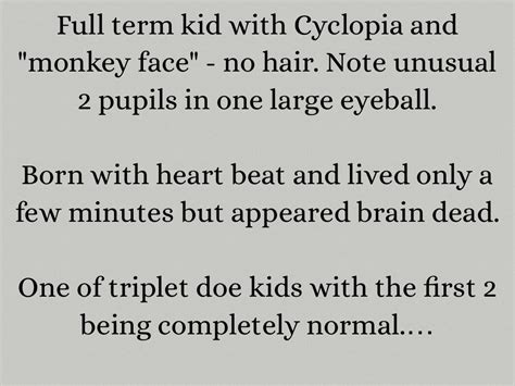 Cyclopia by Skylar Anderson