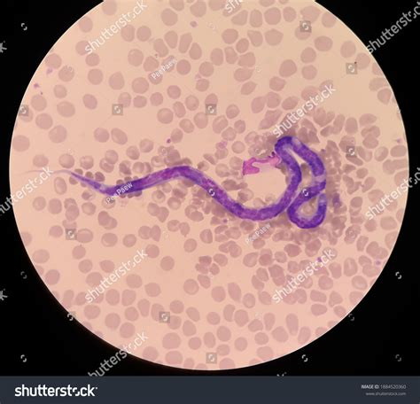 Microfilariae Not Sheathed Blood Smear Dog Stock Photo (Edit Now ...